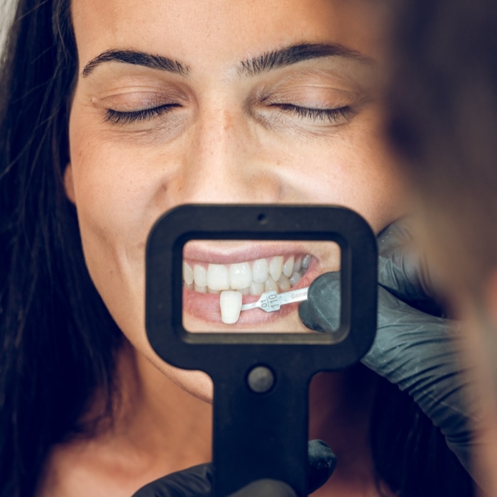 Femme souriante applique facette dentaires 
